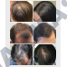 Anti Hair Loss Serum Hair Growth